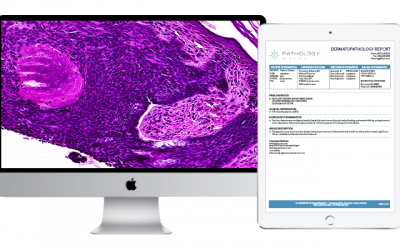 Eliminating Four Common Barriers Between Dermatologists and Digital Pathology