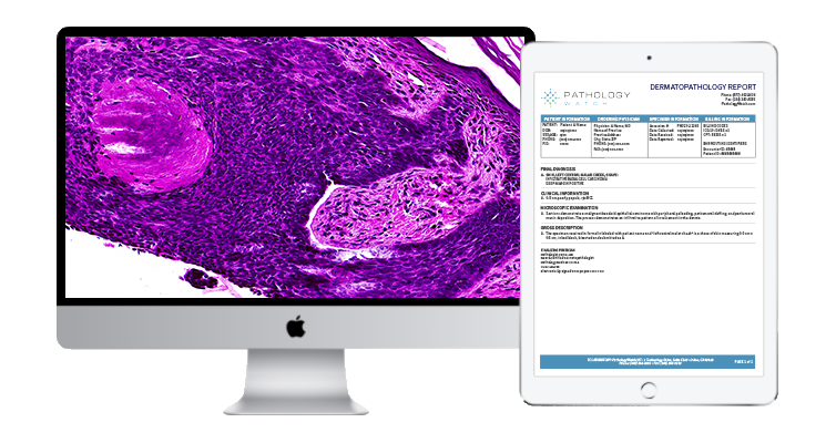 Eliminating Four Common Barriers Between Dermatologists and Digital Pathology