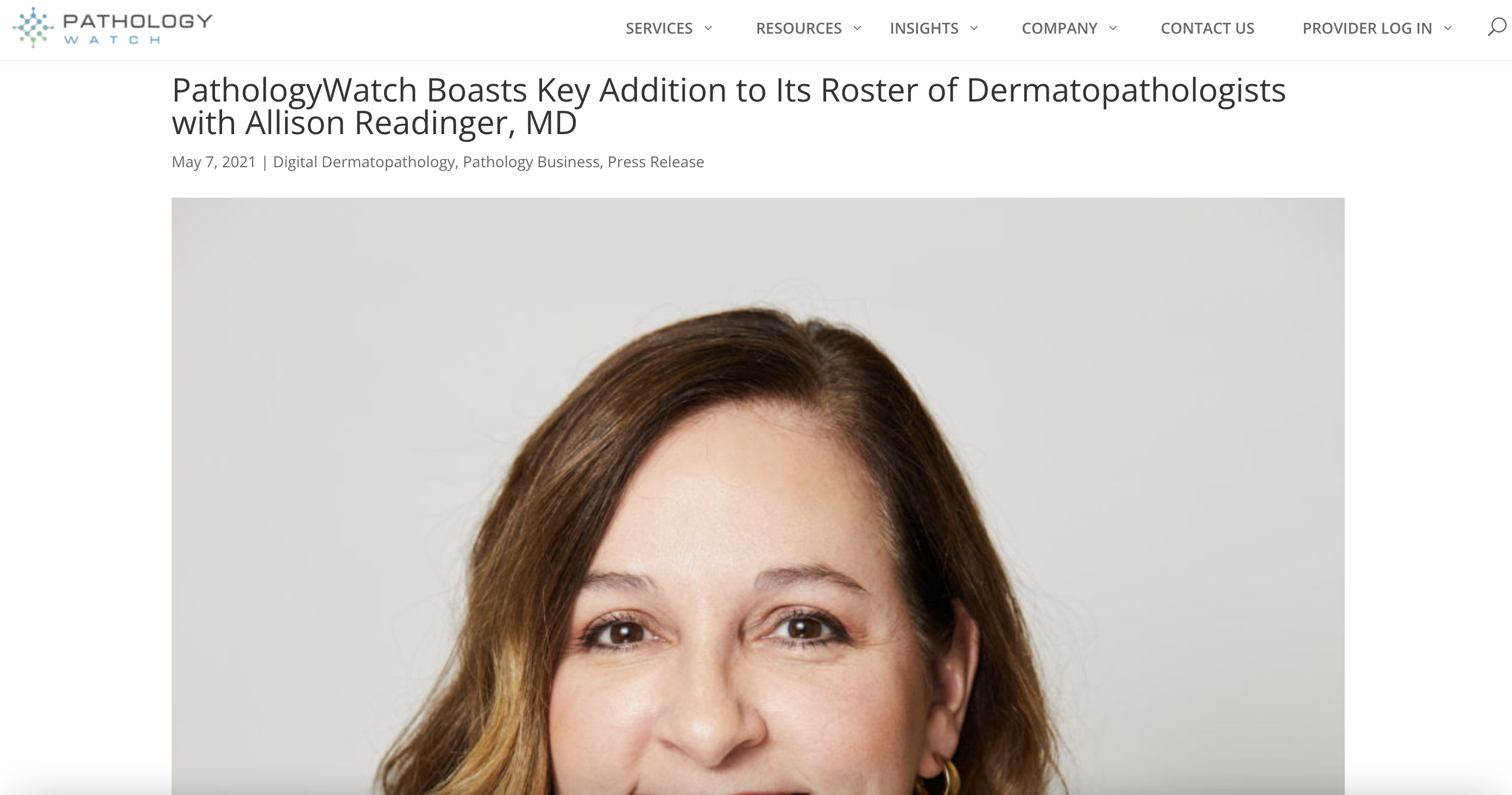 PathologyWatch Boasts Key Addition to Its Roster of Dermatopathologists with Allison Readinger, MD